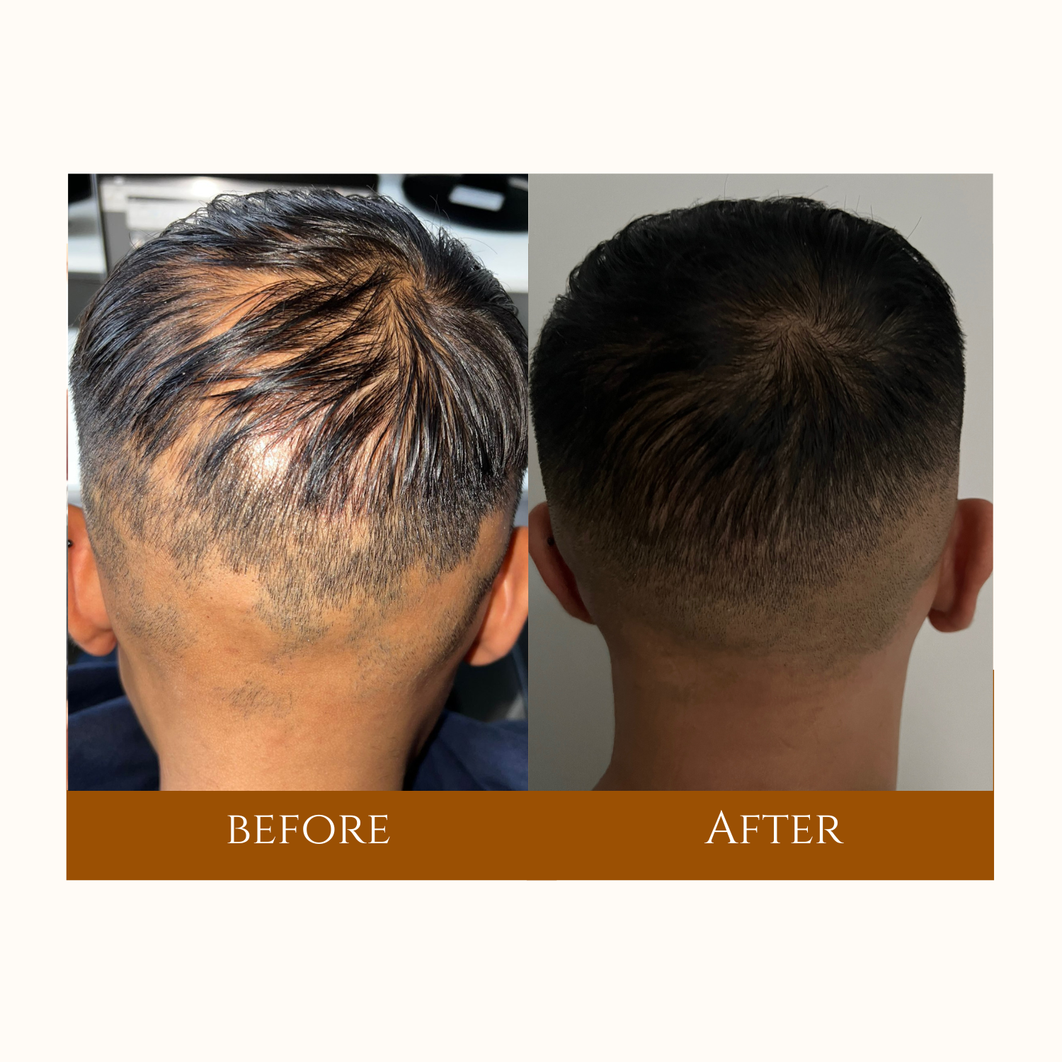 Before-and-after images revealing a dramatic boost in hair length and volume with extensions.