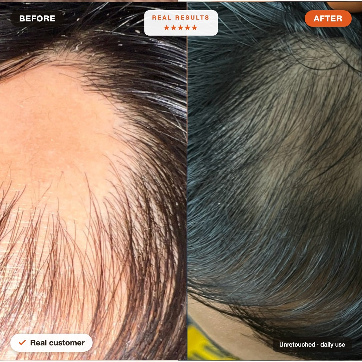 Hair Veda Avani real customer before and after hair growth result